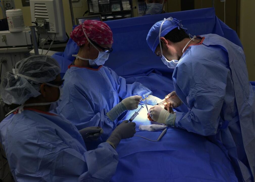 prostatitis surgery